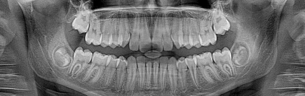 - Pure Gold Professionals in Dentistry - Dentist in Redlands - Pure Gold Professionals in Dentistry - Dentist in Redlands - Dentist in Redlands