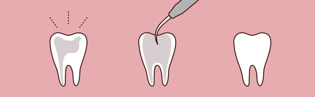 - Pure Gold Professionals in Dentistry - Dentist in Redlands - Pure Gold Professionals in Dentistry - Dentist in Redlands - Dentist in Redlands