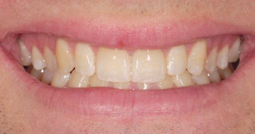 - Pure Gold Professionals in Dentistry - Dentist in Redlands - Pure Gold Professionals in Dentistry - Dentist in Redlands - Dentist in Redlands
