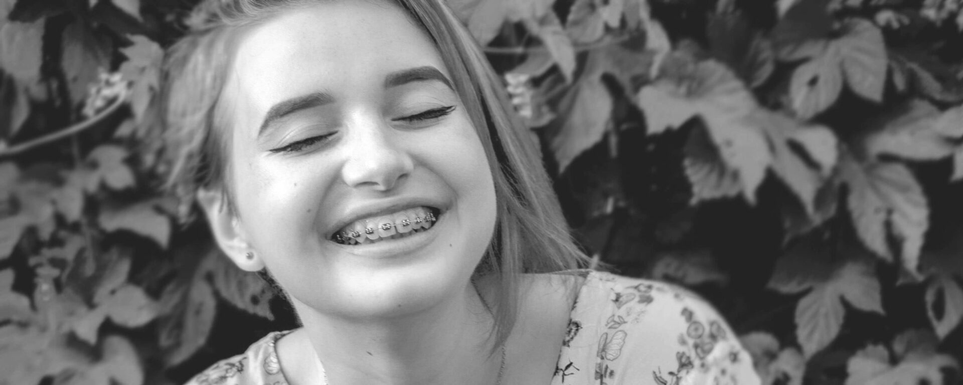 Orthodontic Treatment - Pure Gold Professionals in Dentistry - Dentist in Redlands - Pure Gold Professionals in Dentistry - Dentist in Redlands - Dentist in Redlands
